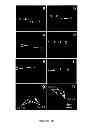 Fig. 14 - FOETAL NUCLEATED RED BLOOD CELL DETECTION