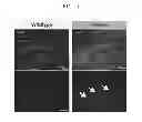 Fig. 06 - Pharmaceutical compositions for preventing or treating degenerative brain disease and method of screening the same