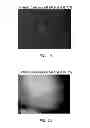 Fig. 16 - Manufacturing and purification processes of Complex protein found in Fraction IV to make a separated Apo, Transferrin, and Alpha 1 Antitrypsin (A1AT) or a combined Transferrin/Apo/Human Albumin/A1AT and all new found proteins