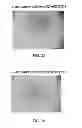 Fig. 18 - Manufacturing and purification processes of Complex protein found in Fraction IV to make a separated Apo, Transferrin, and Alpha 1 Antitrypsin (A1AT) or a combined Transferrin/Apo/Human Albumin/A1AT and all new found proteins
