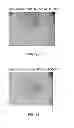 Fig. 19 - Manufacturing and purification processes of Complex protein found in Fraction IV to make a separated Apo, Transferrin, and Alpha 1 Antitrypsin (A1AT) or a combined Transferrin/Apo/Human Albumin/A1AT and all new found proteins
