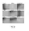 Fig. 28 - Manufacturing and purification processes of Complex protein found in Fraction IV to make a separated Apo, Transferrin, and Alpha 1 Antitrypsin (A1AT) or a combined Transferrin/Apo/Human Albumin/A1AT and all new found proteins