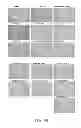 Fig. 31 - Manufacturing and purification processes of Complex protein found in Fraction IV to make a separated Apo, Transferrin, and Alpha 1 Antitrypsin (A1AT) or a combined Transferrin/Apo/Human Albumin/A1AT and all new found proteins