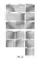 Fig. 33 - Manufacturing and purification processes of Complex protein found in Fraction IV to make a separated Apo, Transferrin, and Alpha 1 Antitrypsin (A1AT) or a combined Transferrin/Apo/Human Albumin/A1AT and all new found proteins