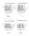 Fig. 44 - Manufacturing and purification processes of Complex protein found in Fraction IV to make a separated Apo, Transferrin, and Alpha 1 Antitrypsin (A1AT) or a combined Transferrin/Apo/Human Albumin/A1AT and all new found proteins