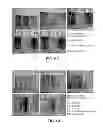 Fig. 47 - Manufacturing and purification processes of Complex protein found in Fraction IV to make a separated Apo, Transferrin, and Alpha 1 Antitrypsin (A1AT) or a combined Transferrin/Apo/Human Albumin/A1AT and all new found proteins