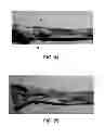 Fig. 56 - Manufacturing and purification processes of Complex protein found in Fraction IV to make a separated Apo, Transferrin, and Alpha 1 Antitrypsin (A1AT) or a combined Transferrin/Apo/Human Albumin/A1AT and all new found proteins