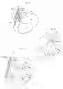 Fig. 06 - Heart help device, system, and method