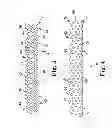 Fig. 06 - Pelvic implants and related methods