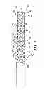 Fig. 08 - Pelvic implants and related methods