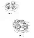 Fig. 06 - Devices and Methods for Promoting Female Sexual Wellness