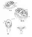 Fig. 07 - Devices and Methods for Promoting Female Sexual Wellness