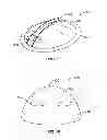 Fig. 11 - Devices and Methods for Promoting Female Sexual Wellness