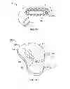 Fig. 12 - Devices and Methods for Promoting Female Sexual Wellness