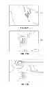 Fig. 29 - Devices and Methods for Promoting Female Sexual Wellness