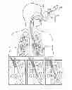 Fig. 01 - MEDICAL SYSTEMS AND METHODS