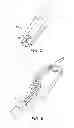 Fig. 06 - Surgical device and component having movable plug portions