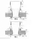 Fig. 07 - Surgical access assembly with sleeve and adjustable fastener