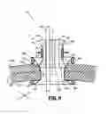 Fig. 08 - Surgical access assembly with sleeve and adjustable fastener