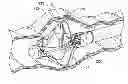 Fig. 01 - Multi-lumen-catheter retractor system for a minimally-invasive, operative gastrointestinal treatment