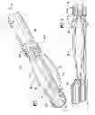 Fig. 02 - Multi-lumen-catheter retractor system for a minimally-invasive, operative gastrointestinal treatment