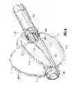 Fig. 03 - Multi-lumen-catheter retractor system for a minimally-invasive, operative gastrointestinal treatment