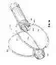 Fig. 04 - Multi-lumen-catheter retractor system for a minimally-invasive, operative gastrointestinal treatment