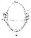 Fig. 05 - Multi-lumen-catheter retractor system for a minimally-invasive, operative gastrointestinal treatment