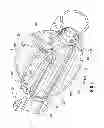 Fig. 06 - Multi-lumen-catheter retractor system for a minimally-invasive, operative gastrointestinal treatment