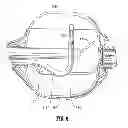 Fig. 07 - Multi-lumen-catheter retractor system for a minimally-invasive, operative gastrointestinal treatment