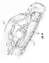 Fig. 10 - Multi-lumen-catheter retractor system for a minimally-invasive, operative gastrointestinal treatment