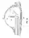 Fig. 11 - Multi-lumen-catheter retractor system for a minimally-invasive, operative gastrointestinal treatment