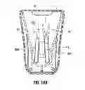 Fig. 12 - Multi-lumen-catheter retractor system for a minimally-invasive, operative gastrointestinal treatment