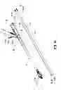 Fig. 13 - Multi-lumen-catheter retractor system for a minimally-invasive, operative gastrointestinal treatment