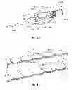 Fig. 14 - Multi-lumen-catheter retractor system for a minimally-invasive, operative gastrointestinal treatment