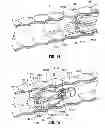 Fig. 15 - Multi-lumen-catheter retractor system for a minimally-invasive, operative gastrointestinal treatment