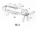 Fig. 16 - Multi-lumen-catheter retractor system for a minimally-invasive, operative gastrointestinal treatment