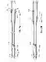 Fig. 17 - Multi-lumen-catheter retractor system for a minimally-invasive, operative gastrointestinal treatment