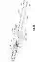 Fig. 19 - Multi-lumen-catheter retractor system for a minimally-invasive, operative gastrointestinal treatment