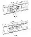Fig. 28 - Multi-lumen-catheter retractor system for a minimally-invasive, operative gastrointestinal treatment