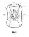 Fig. 29 - Multi-lumen-catheter retractor system for a minimally-invasive, operative gastrointestinal treatment