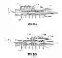 Fig. 30 - Multi-lumen-catheter retractor system for a minimally-invasive, operative gastrointestinal treatment