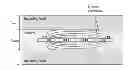 Fig. 01 - MULTIFUNCTIONAL GUIDEWIRE ASSEMBLIES AND SYSTEM FOR ANALYZING ANATOMICAL AND FUNCTIONAL PARAMETERS