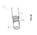 Fig. 32 - MULTIFUNCTIONAL GUIDEWIRE ASSEMBLIES AND SYSTEM FOR ANALYZING ANATOMICAL AND FUNCTIONAL PARAMETERS