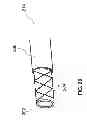Fig. 33 - MULTIFUNCTIONAL GUIDEWIRE ASSEMBLIES AND SYSTEM FOR ANALYZING ANATOMICAL AND FUNCTIONAL PARAMETERS