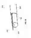 Fig. 35 - MULTIFUNCTIONAL GUIDEWIRE ASSEMBLIES AND SYSTEM FOR ANALYZING ANATOMICAL AND FUNCTIONAL PARAMETERS
