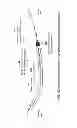 Fig. 66 - MULTIFUNCTIONAL GUIDEWIRE ASSEMBLIES AND SYSTEM FOR ANALYZING ANATOMICAL AND FUNCTIONAL PARAMETERS