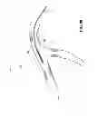 Fig. 83 - MULTIFUNCTIONAL GUIDEWIRE ASSEMBLIES AND SYSTEM FOR ANALYZING ANATOMICAL AND FUNCTIONAL PARAMETERS