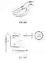 Fig. 89 - MULTIFUNCTIONAL GUIDEWIRE ASSEMBLIES AND SYSTEM FOR ANALYZING ANATOMICAL AND FUNCTIONAL PARAMETERS