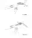 Fig. 93 - MULTIFUNCTIONAL GUIDEWIRE ASSEMBLIES AND SYSTEM FOR ANALYZING ANATOMICAL AND FUNCTIONAL PARAMETERS